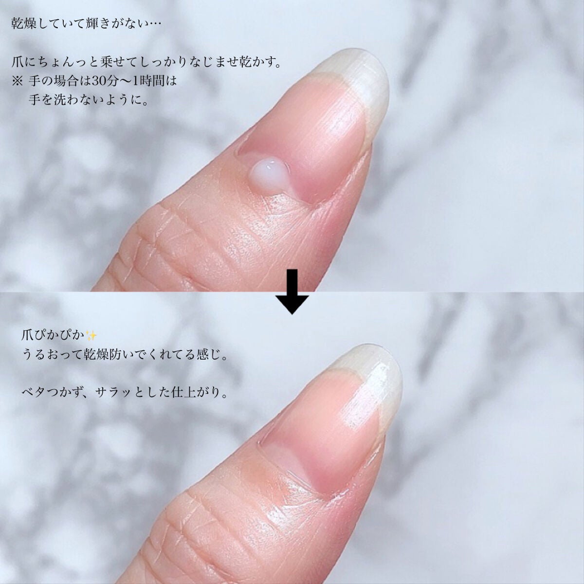 薬用 クリアストロングショット アルファ/北の快適工房/レッグ・フットケアを使ったクチコミ(5枚目)