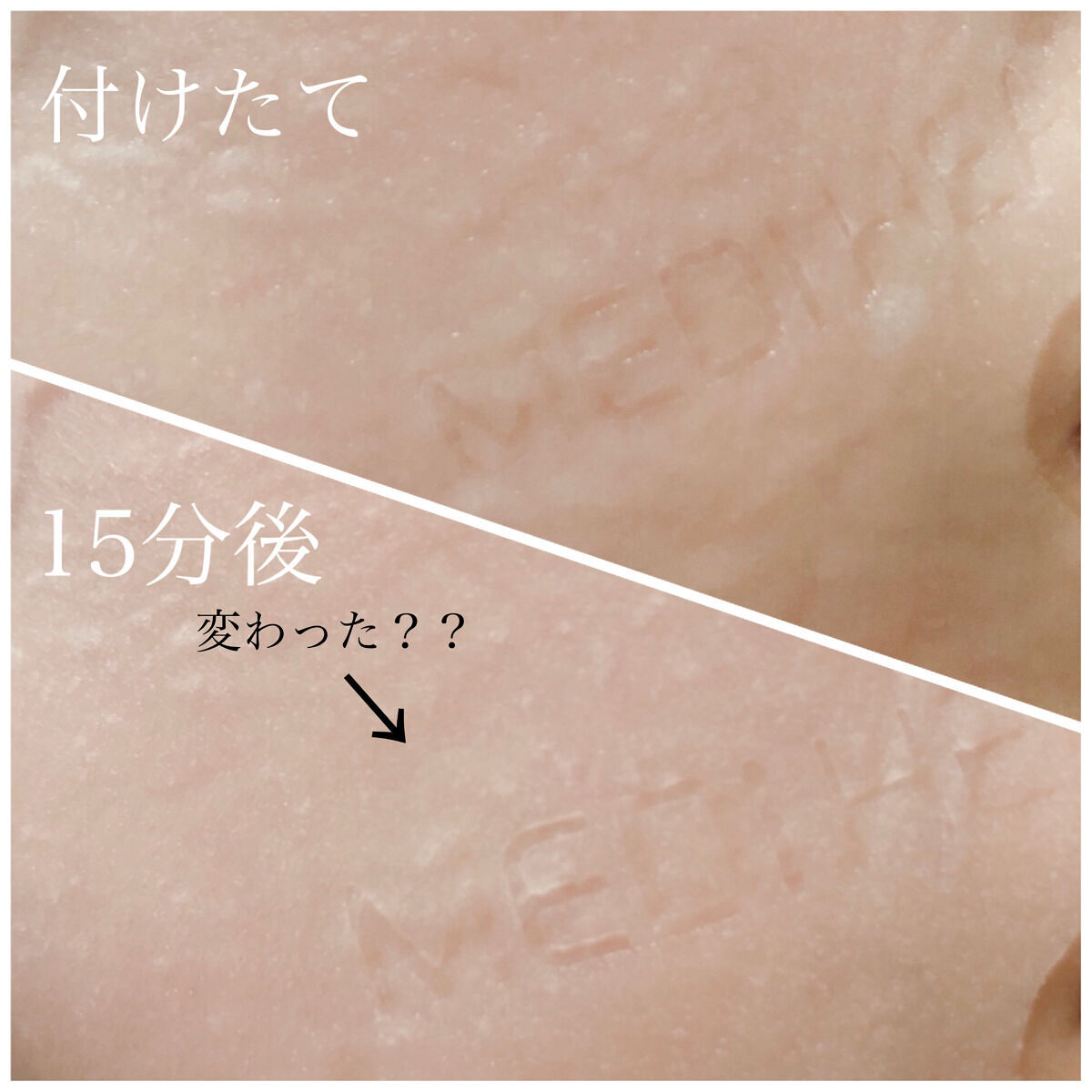 I.P.IライトマックスAPマスクEX/MEDIHEAL/シートマスク・パックを使ったクチコミ（2枚目）