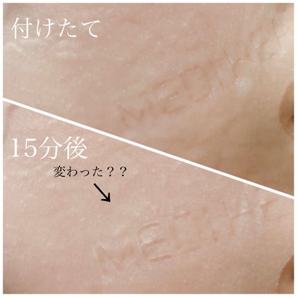 I.P.IライトマックスAPマスクEX/MEDIHEAL/シートマスク・パックを使ったクチコミ(2枚目)