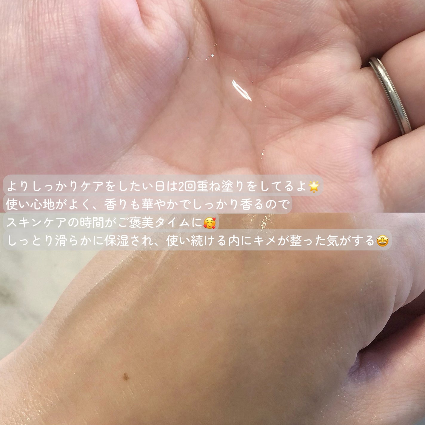 オイデルミン エッセンスローション/SHISEIDO/化粧水を使ったクチコミ(3枚目)