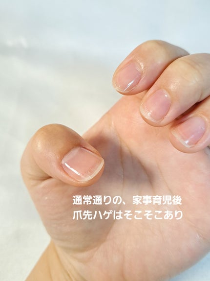 ストロングガード/D-UP/ネイル・ネイルケアを使ったクチコミ(4枚目)