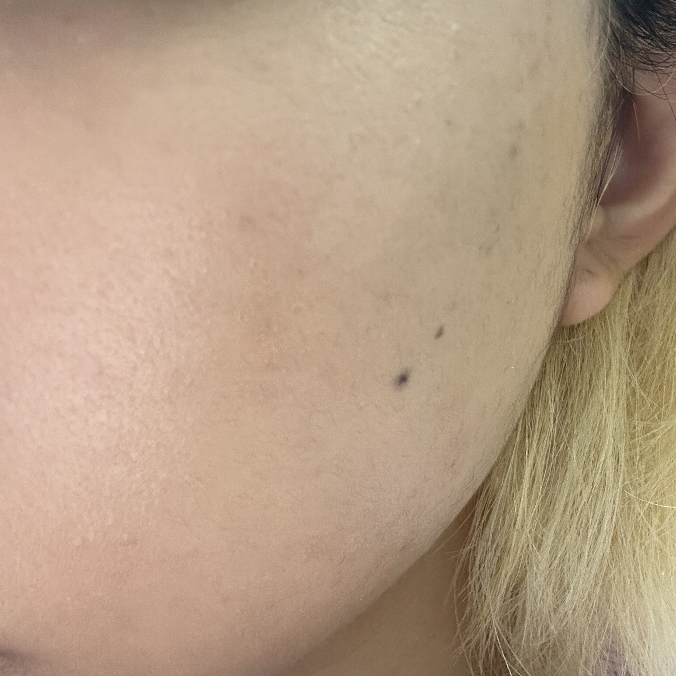 アイレノールすっぴんクリーム 3.0/IRENOL/クリームコンシーラーを使ったクチコミ（3枚目）