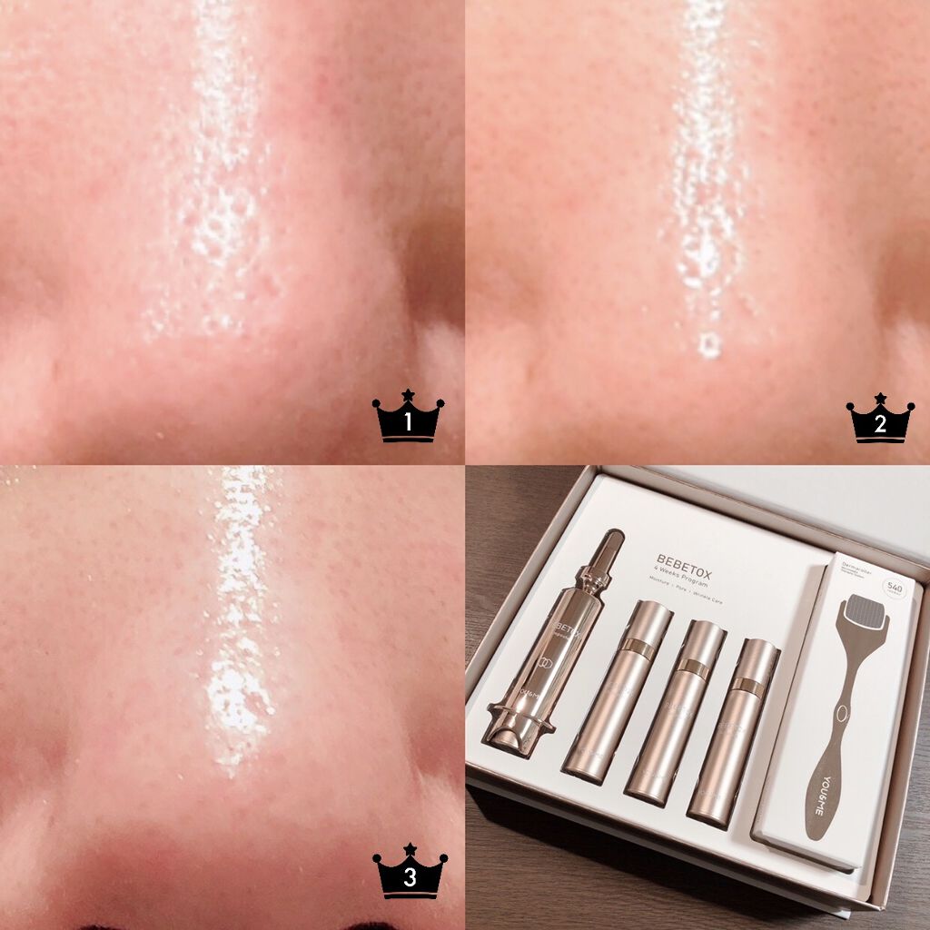 BEBETOXアンプルセット/YOU&ME/スキンケアキットを使ったクチコミ（3枚目）
