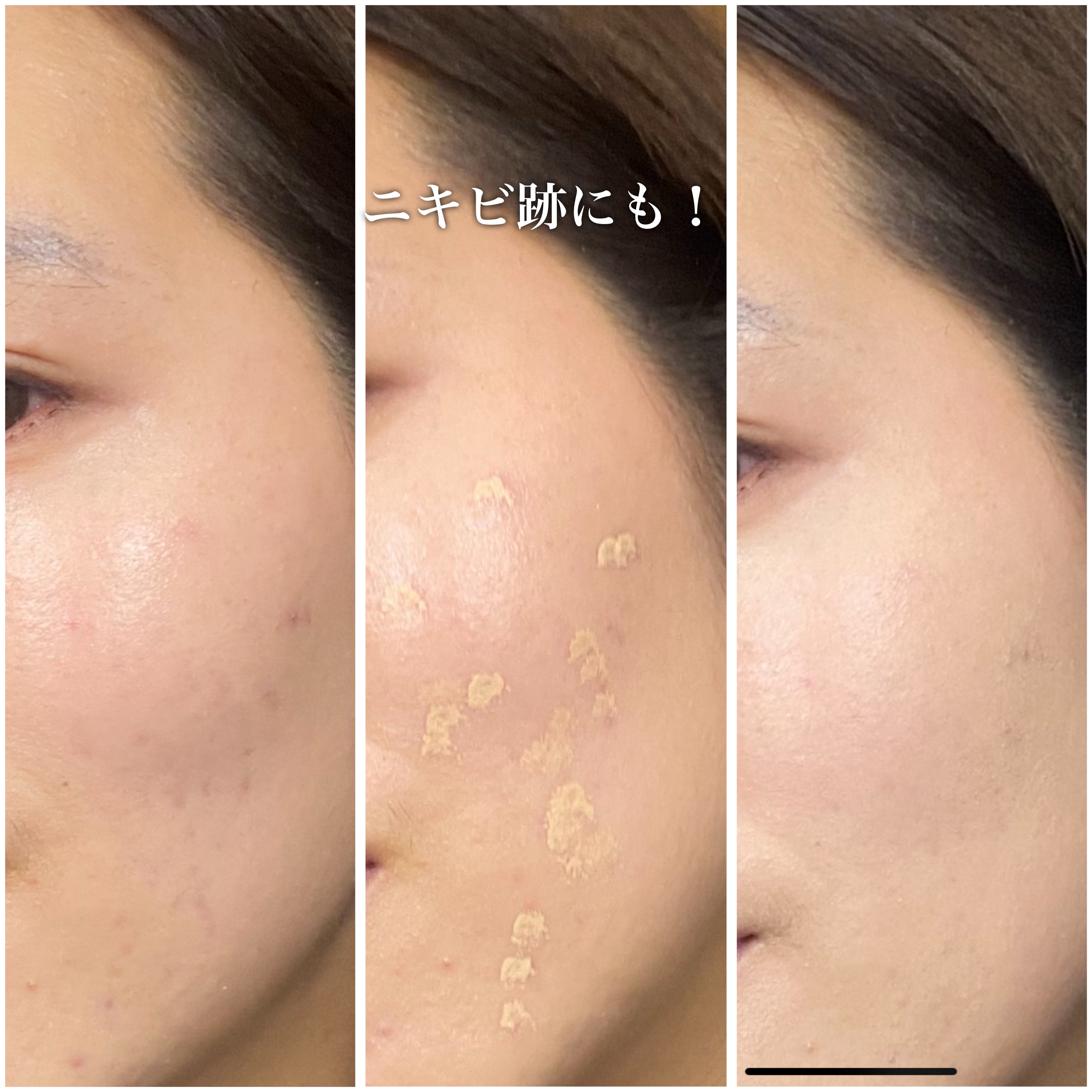 ダーマシンコンシーラー/23years old/リキッドコンシーラーを使ったクチコミ（3枚目）