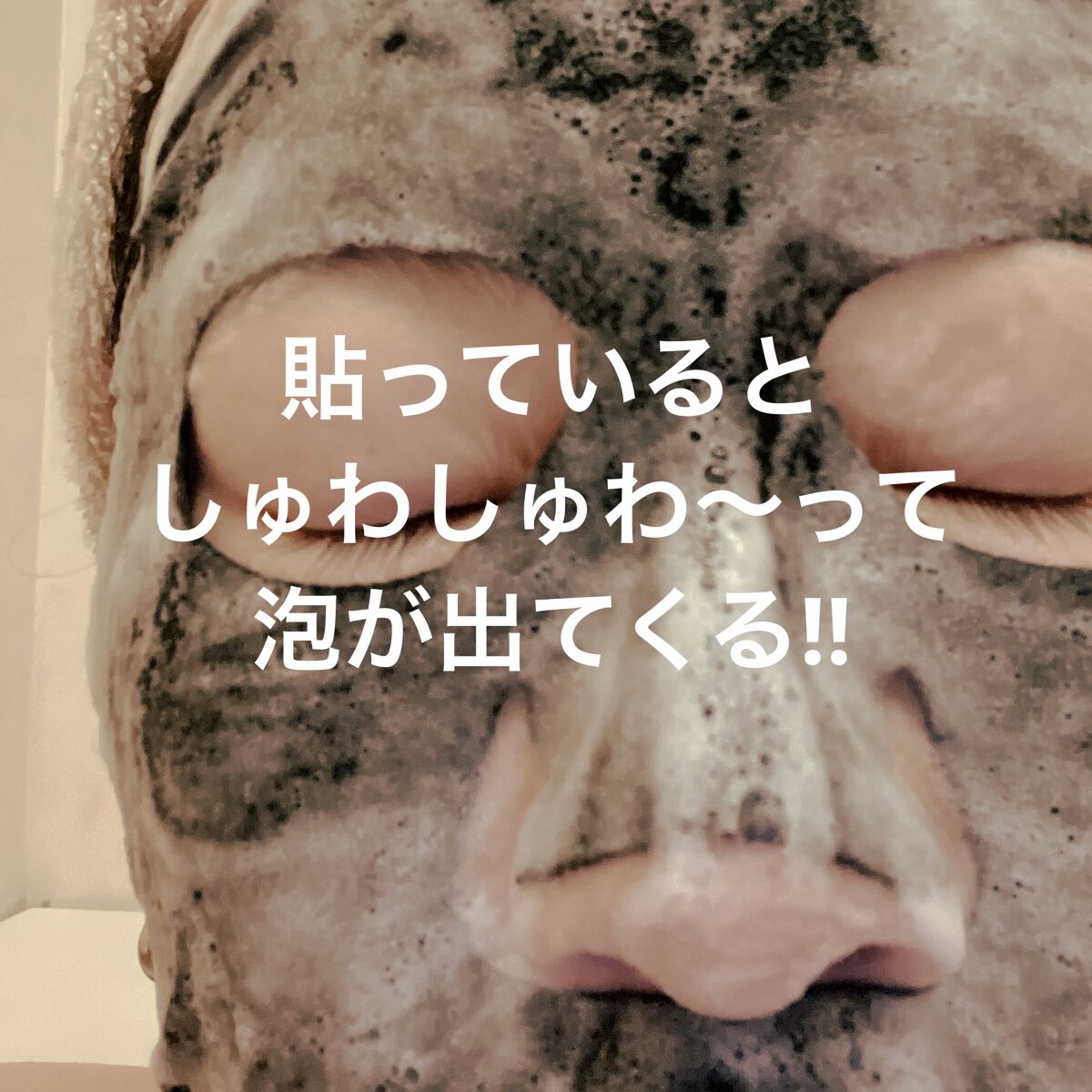BLACK O2 泡パック charcoal /PUREDERM/シートマスク・パックを使ったクチコミ（2枚目）