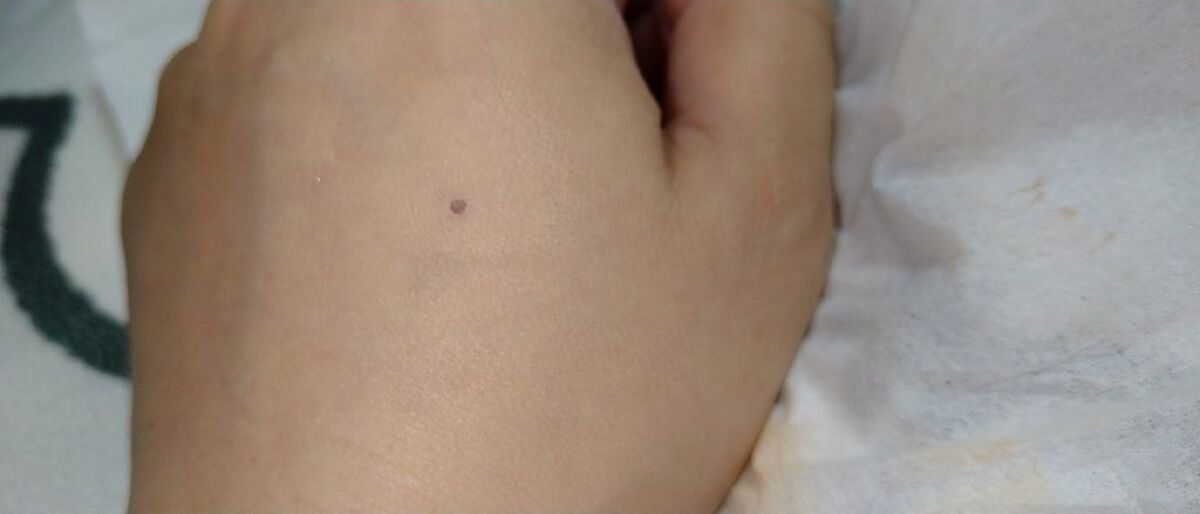 マスクフィットオールカバーデュアルコンシーラー/TIRTIR(ティルティル)/コンシーラーを使ったクチコミ(6枚目)