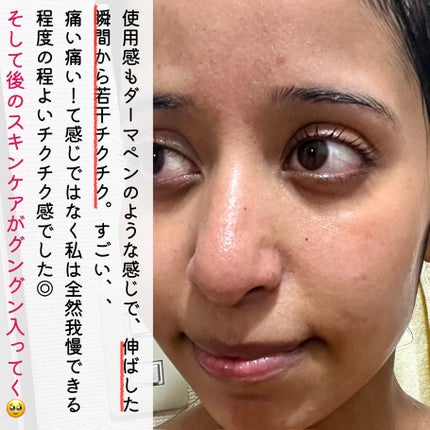 シカバイタル マスク/VT/シートマスク・パックを使ったクチコミ(5枚目)