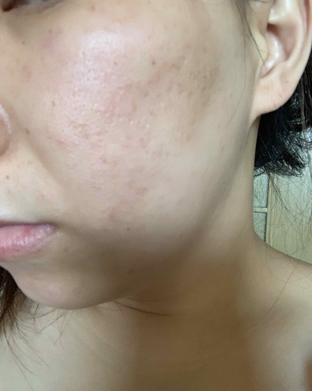 フレーシュボーテN/ドルックス/乳液を使ったクチコミ（3枚目）