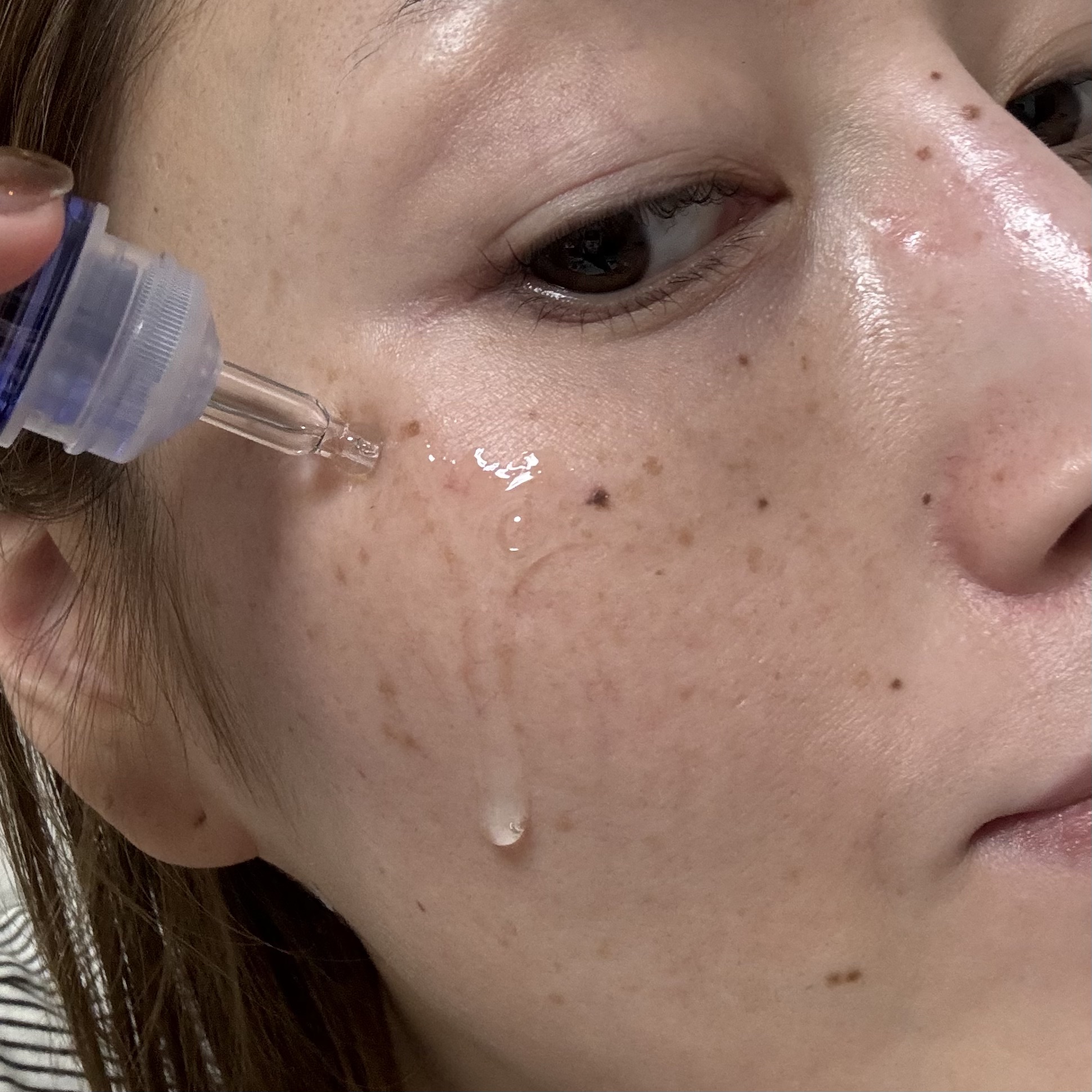 5種の原液MIX エンリッチ/Bアンプル/美容液を使ったクチコミ（3枚目）