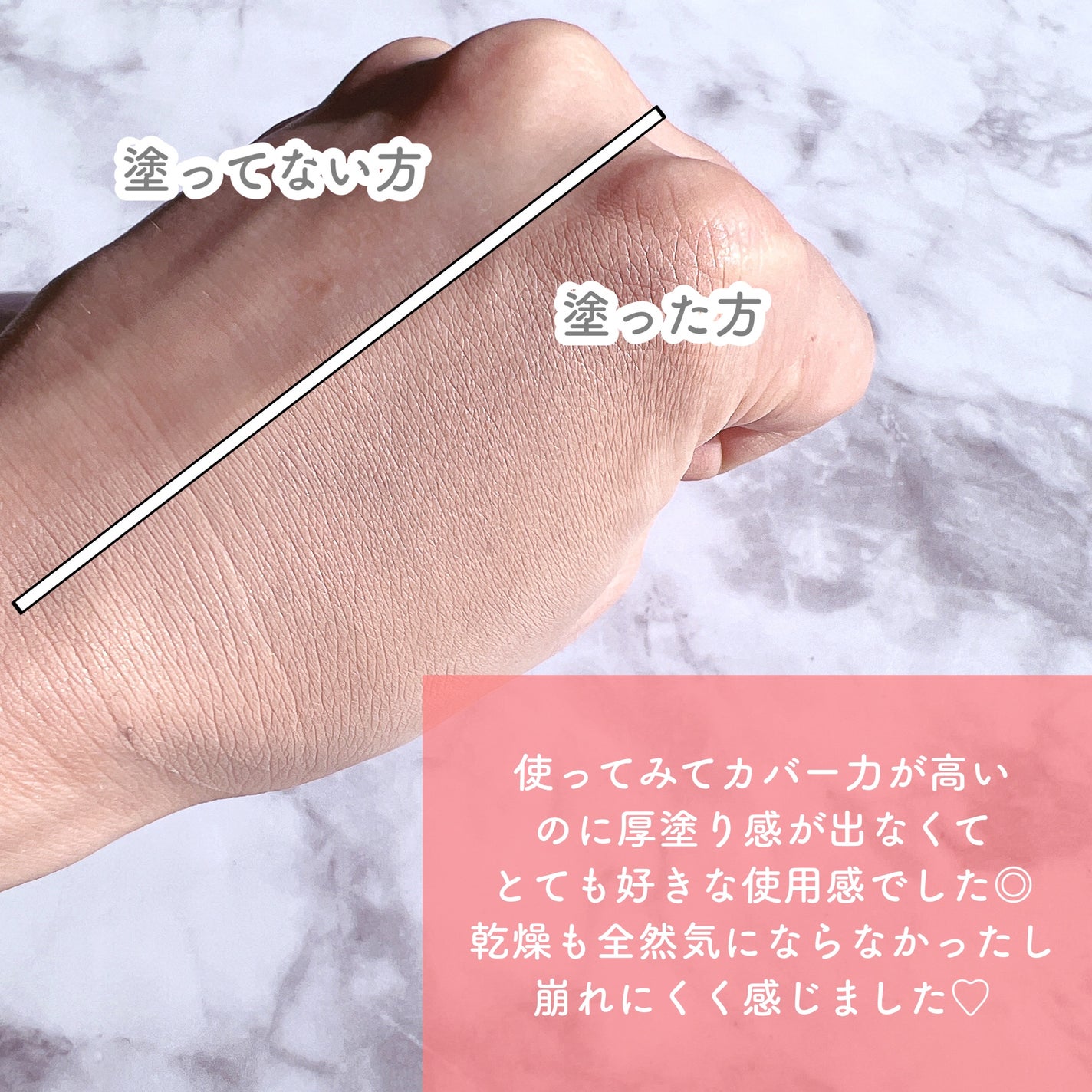 ãã³ã¯ãã£ãŒããªãŒã«ããŒãã©ã€ããŒã¯ãã·ã§ã³/APLIN/ã¯ãã·ã§ã³ãã¡ã³ããŒã·ã§ã³ã䜿ã£ãã¯ãã³ãïŒ4æç®ïŒ