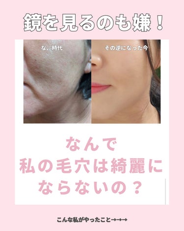 美肌カウンセラー💆綺麗のお助け相談所 on LIPS 「肌を綺麗にする専門家💆美肌カウンセラー洗顔で可愛くなる時代＼肌..」（2枚目）