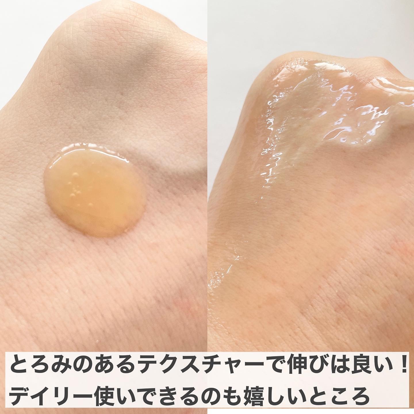 レッドアクネピーリングセラム/MEDICUBE/美容液を使ったクチコミ（3枚目）