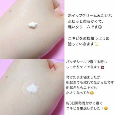 アクネスラボ 薬用ニキビケア スポッツクリームのクチコミ「☆ニキビ撃退クリーム☆﻿
﻿
#アクネスラボ﻿
﻿
大きなニキビが出来た時に﻿
さすか.....」（3枚目）