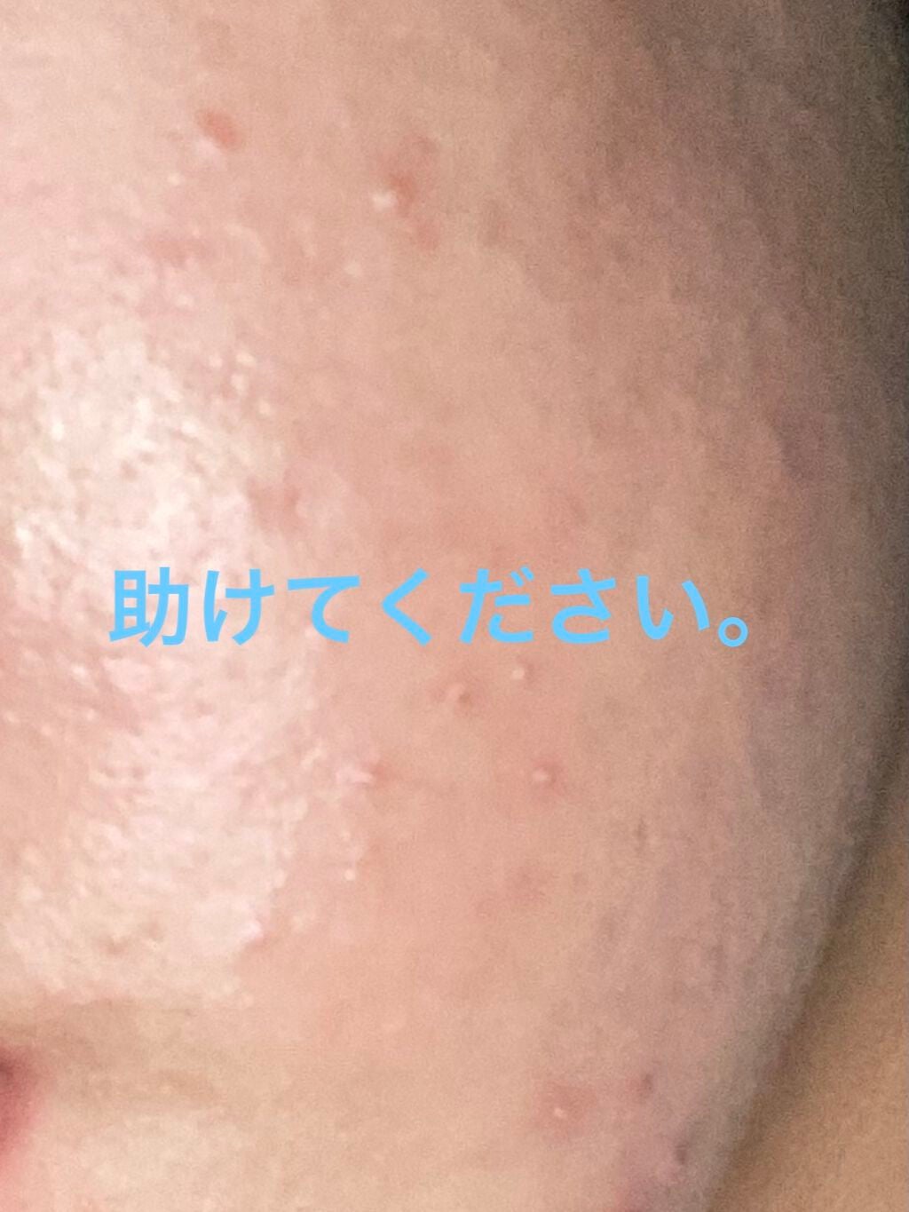 クリーム/キュレル/ボディクリームを使ったクチコミ(1枚目)