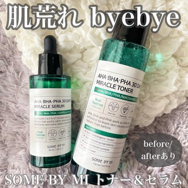 SOME BY MI AHA·BHA·PHA 30デイズミラクルトナーのクチコミ「.
吹き出物対策におすすめの
SOME BY MIの
AHA BHA PHA 30デイズシ.....」（1枚目）