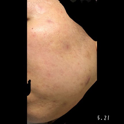 を使ったクチコミ(2枚目)