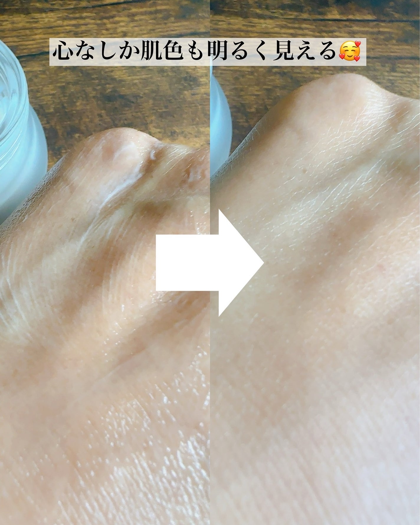 まるみ♡ on LIPS 「韓国の俳優、モデル、皮膚科医が一緒に作ったエクソソームスキンケ..」(6枚目)