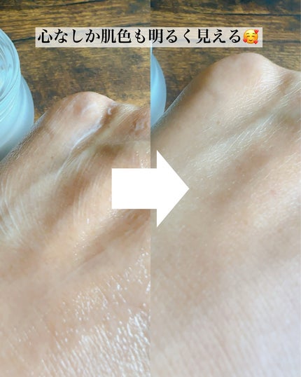 まるみ♡ on LIPS 「韓国の俳優、モデル、皮膚科医が一緒に作ったエクソソームスキンケ..」(6枚目)