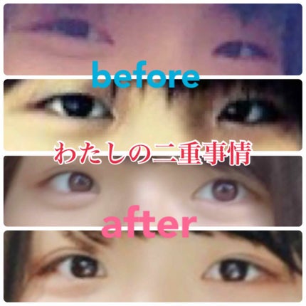 つけまつげ用接着剤/DAISO/つけまつげを使ったクチコミ(1枚目)