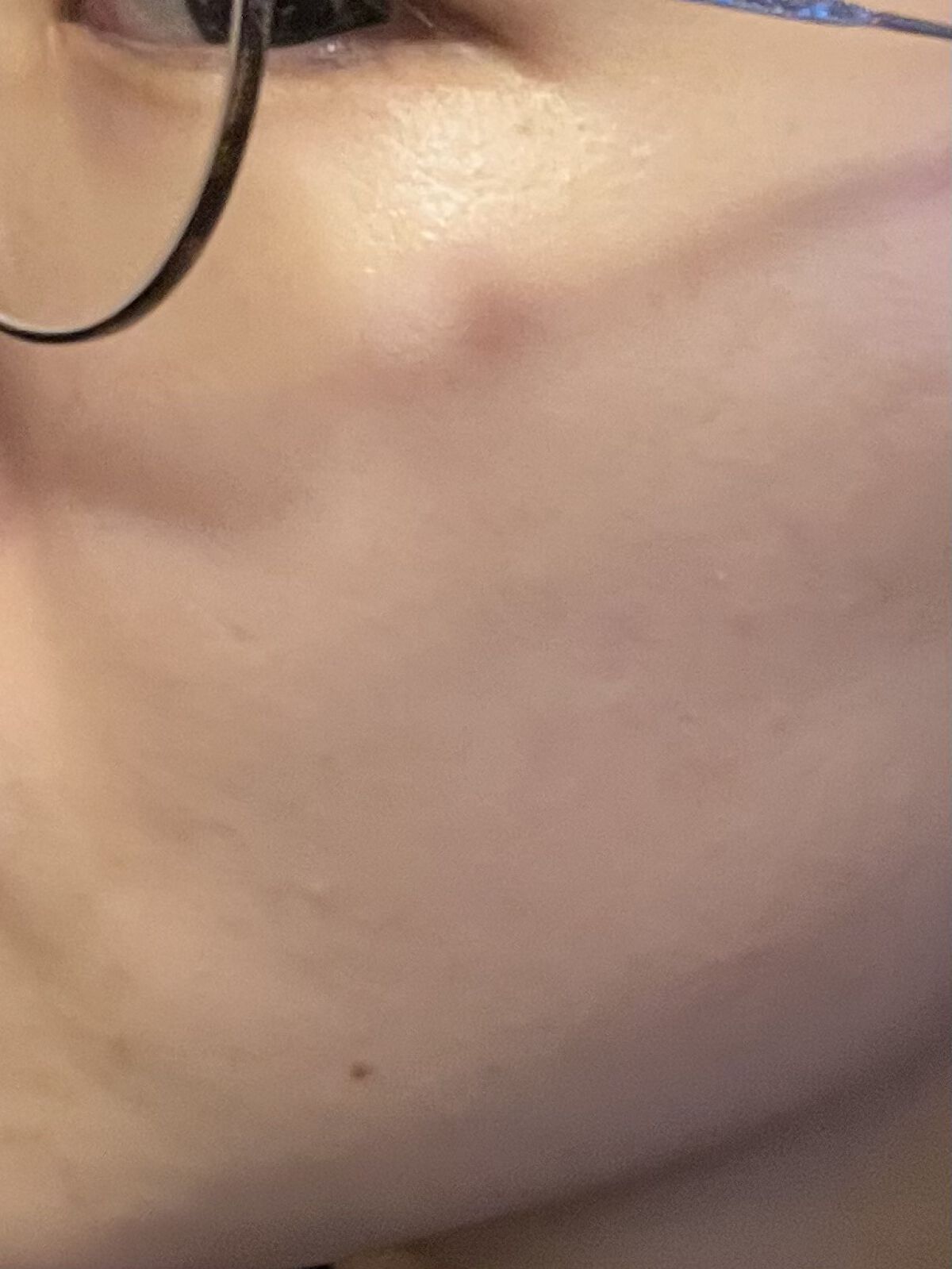 ハトムギ化粧水(ナチュリエ スキンコンディショナー R )/ナチュリエ/化粧水を使ったクチコミ（3枚目）