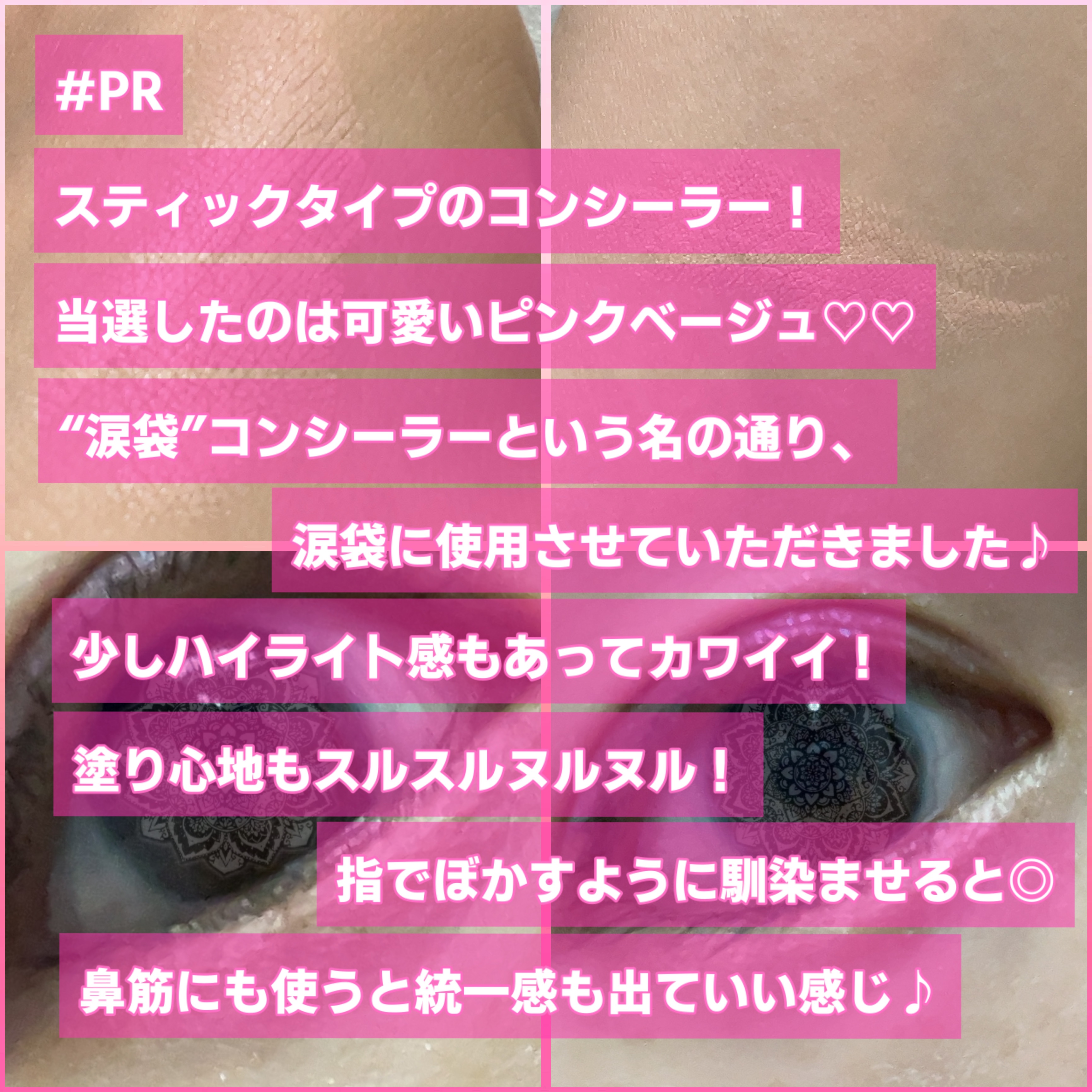 パルガントン 涙袋コンシーラー/パルガントン/スティックコンシーラーを使ったクチコミ（2枚目）