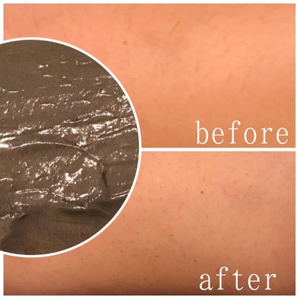 薬用ブラックリムーバー/RODOMIS/除毛クリームを使ったクチコミ(6枚目)