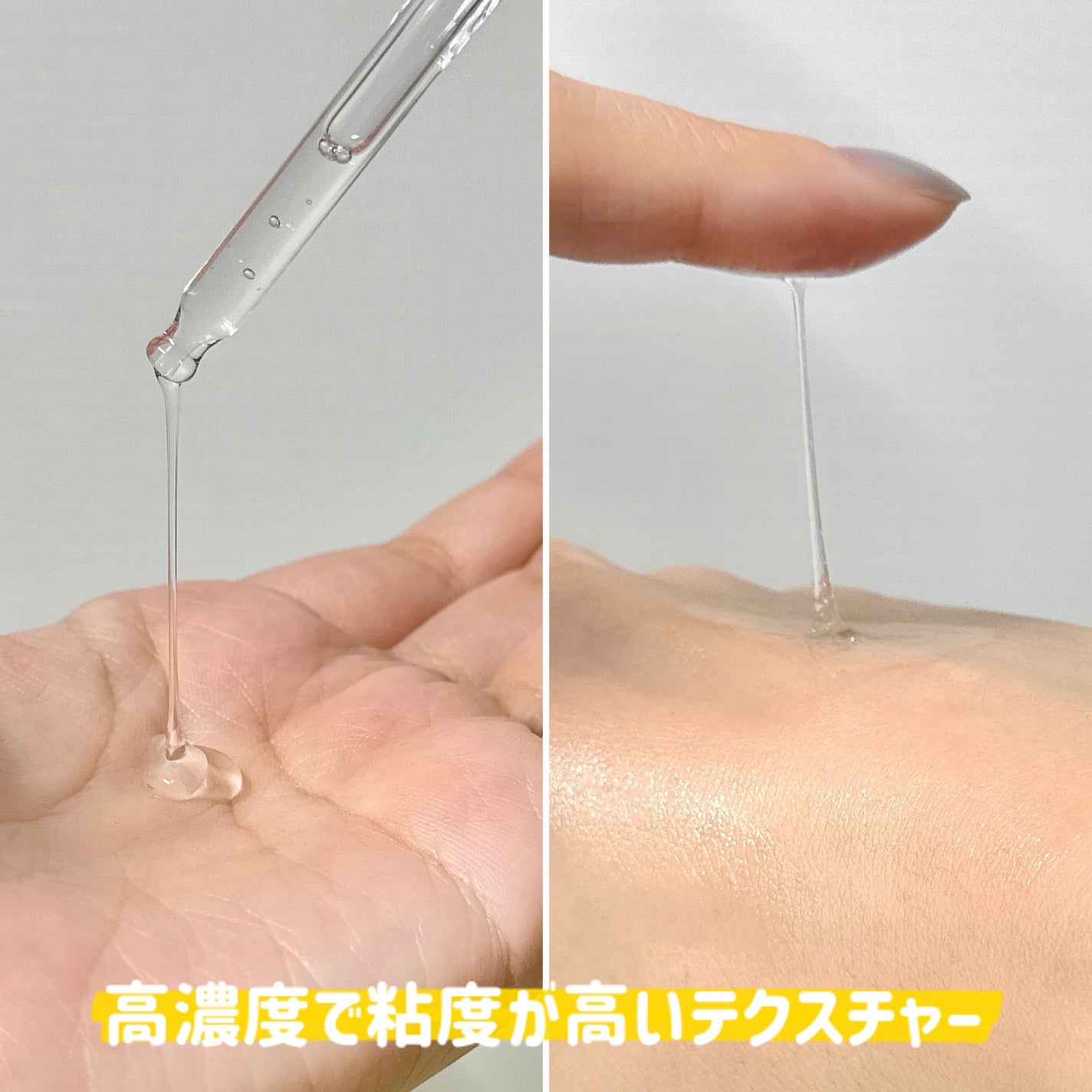 リマージ糸リフティングアンプル/REVENIP/美容液を使ったクチコミ(2枚目)