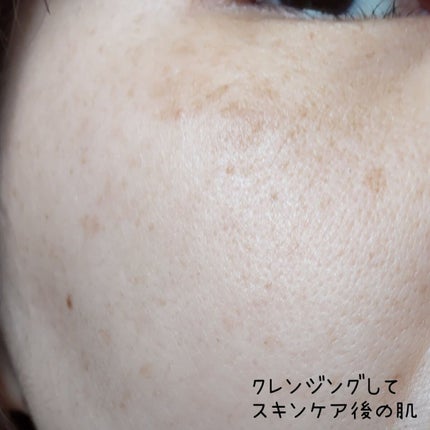 トリートメント クレンジング ミルク/COVERMARK/ミルククレンジングを使ったクチコミ(3枚目)