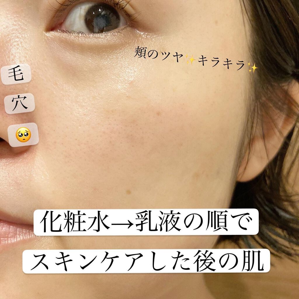 塗る米ぬか化粧水/米一途/化粧水を使ったクチコミ(6枚目)