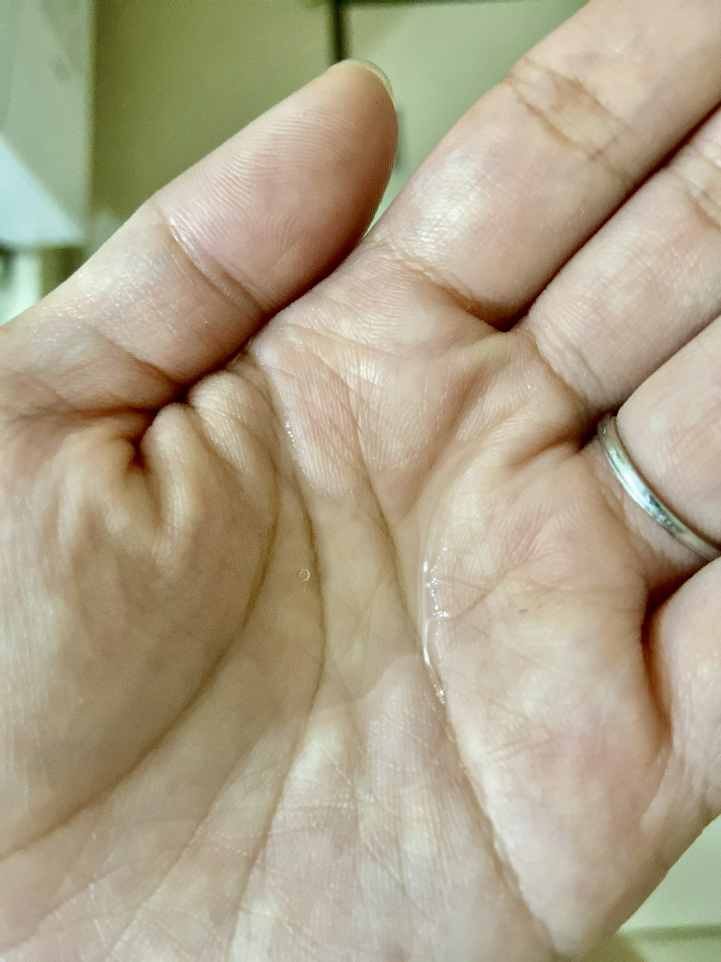 センテラ アンプル/SKIN1004/美容液を使ったクチコミ（1枚目）