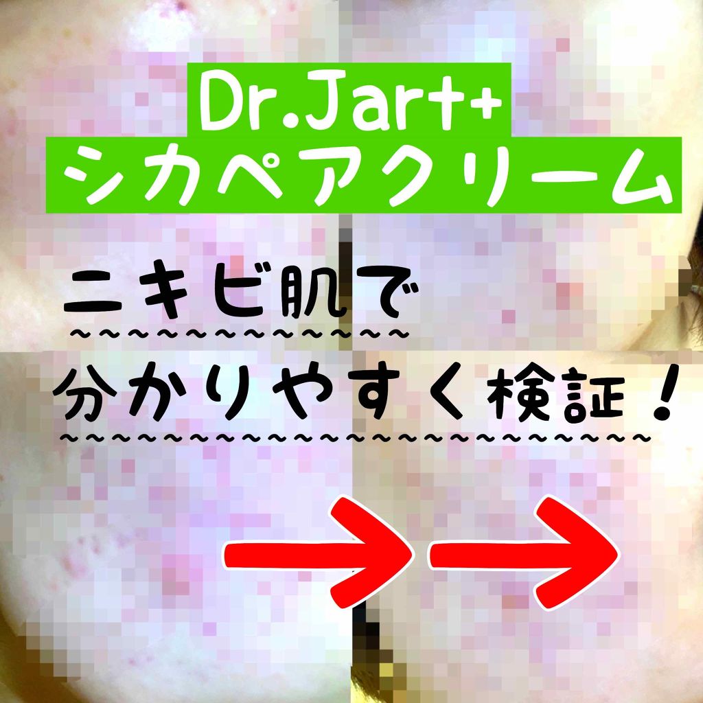 ドクタージャルト シカペア クリーム （第2世代）/Dr.Jart＋/フェイスクリームを使ったクチコミ（1枚目）