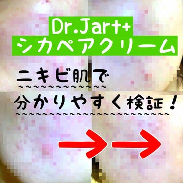 ドクタージャルト シカペア クリーム （第2世代）/Dr.Jart＋/フェイスクリームを使ったクチコミ（1枚目）