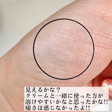 京薬粧 薬用ニードル美容液/京薬粧/美容液を使ったクチコミ(4枚目)