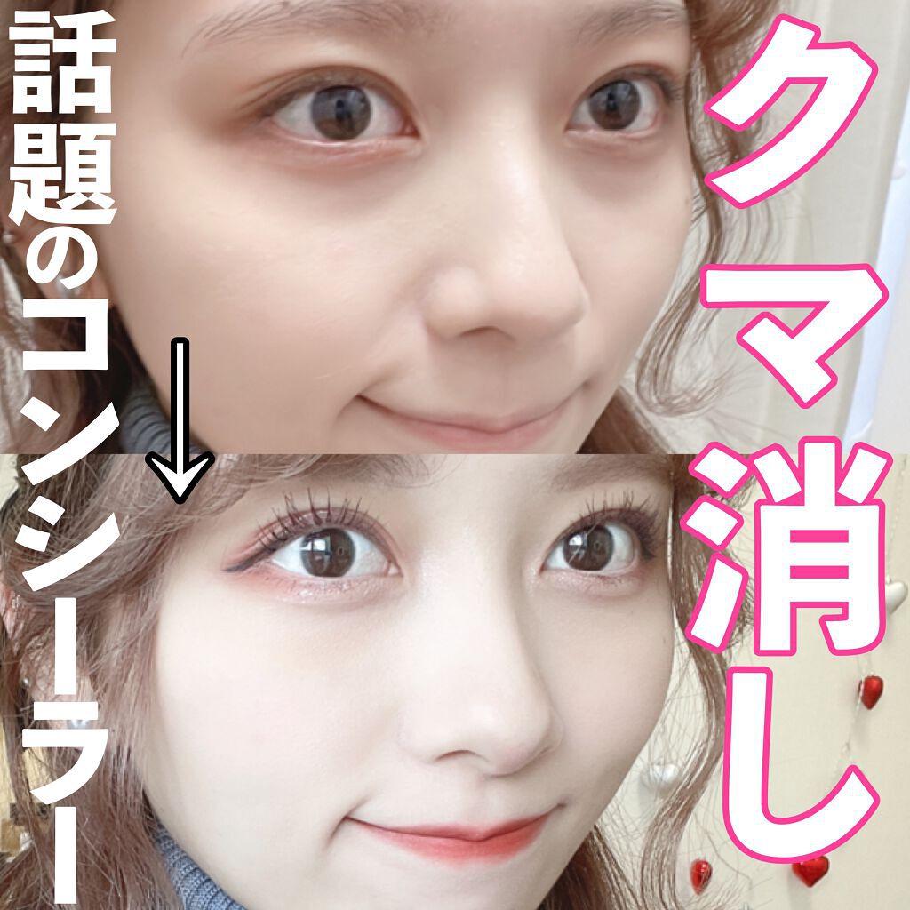 【旧】ディオールスキン フォーエヴァー スキン コレクト コンシーラー/Dior/リキッドコンシーラーを使ったクチコミ(1枚目)