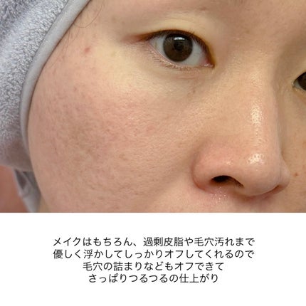 センテラ ライトクレンジングオイル/SKIN1004/オイルクレンジングを使ったクチコミ(7枚目)