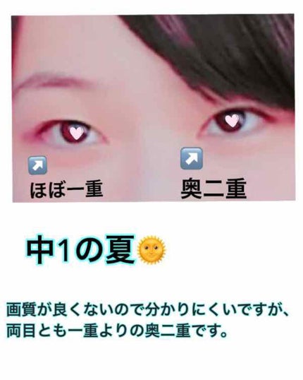 アイトーク/アイトーク/二重まぶた用アイテムを使ったクチコミ(2枚目)