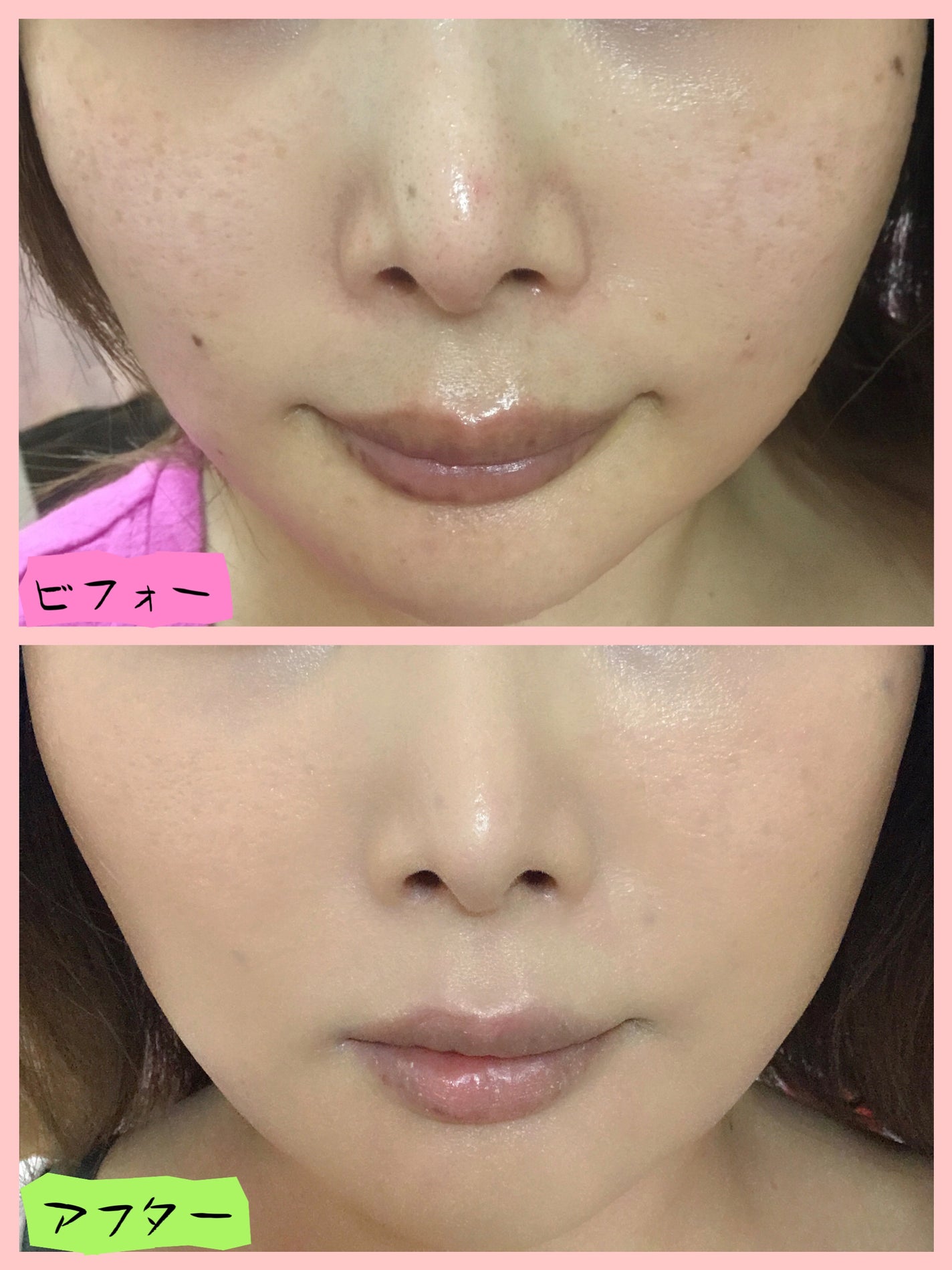 薬用リンクルケアファンデーション(ハイカバー)|WrinkFadeの 薬用リンクルケアファンデーション(ハイカバー)|WrinkFadeの