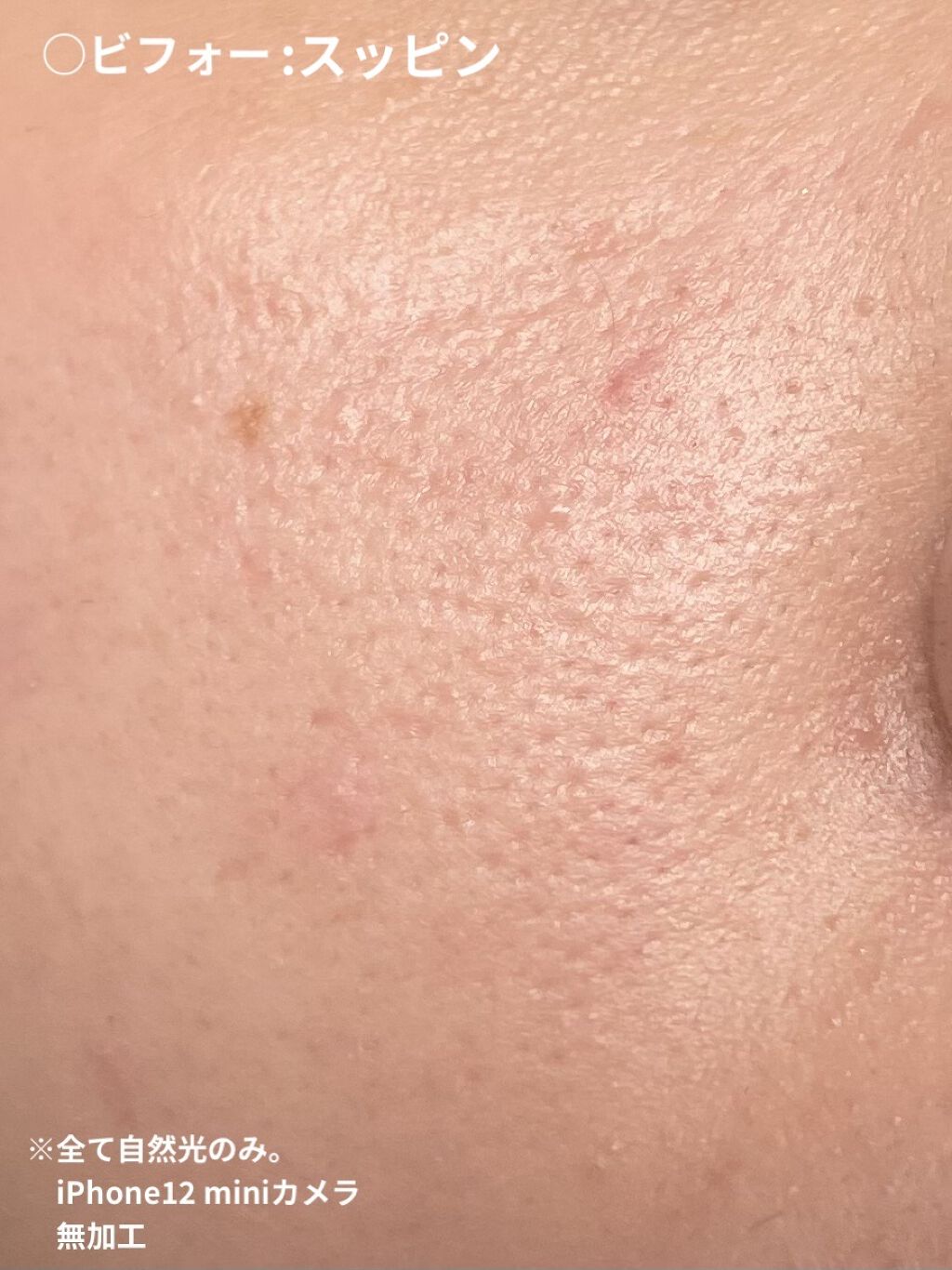 キル カバー フィクサー クッション/CLIO/クッションファンデーションを使ったクチコミ（3枚目）