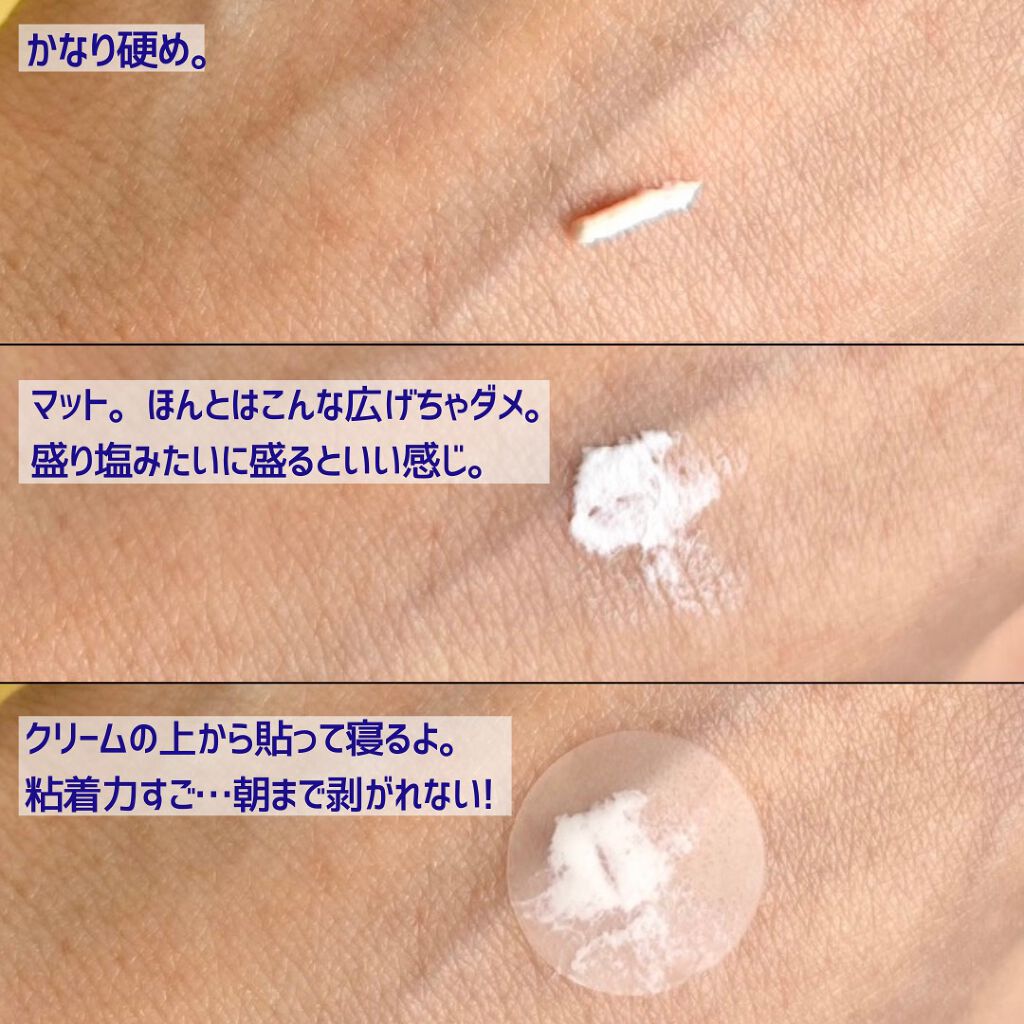 薬用ニキビケア スポッツクリーム/アクネスラボ/フェイスクリームを使ったクチコミ(5枚目)