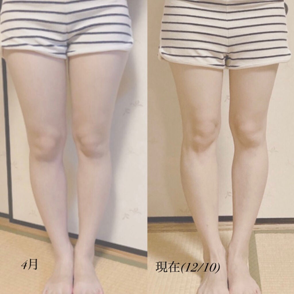 寝ながらメディキュット スパッツ 骨盤テーピング/メディキュット/着圧ソックス・レギンスを使ったクチコミ(2枚目)