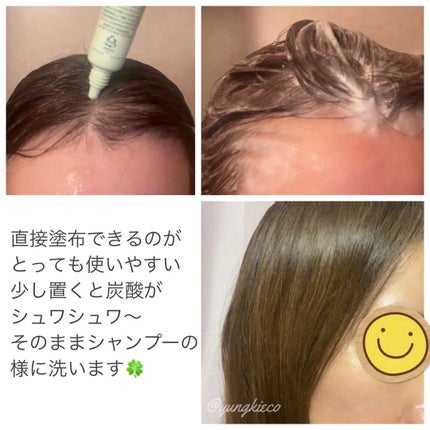 スパークリングスカルプスケーラー/ミンツリー/頭皮ケアを使ったクチコミ(2枚目)