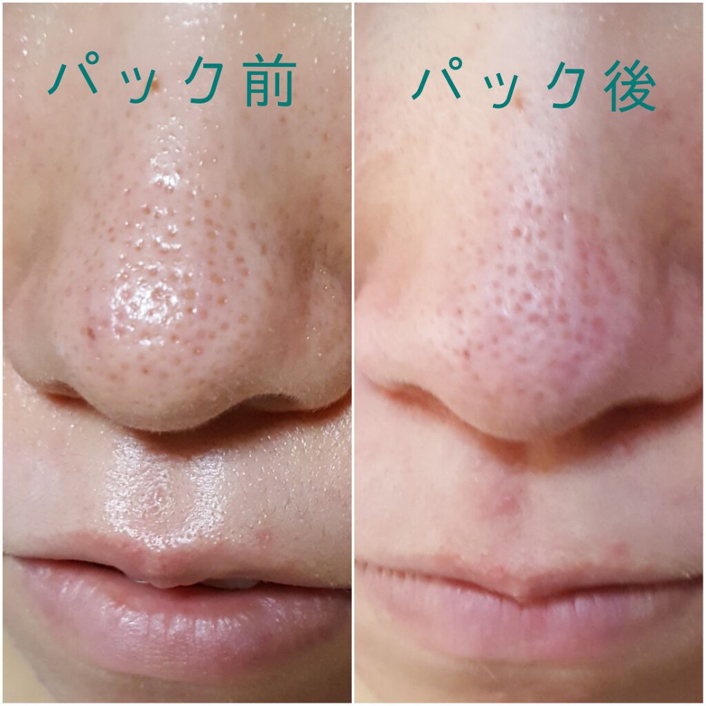 ネイチャーズフォークリア&チャージクレイ/Natures for/洗い流すパック・マスクを使ったクチコミ(2枚目)