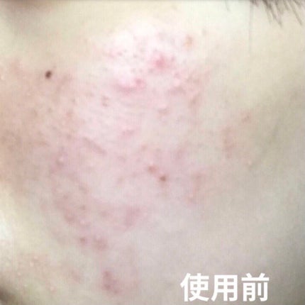 ドクタージャルト シカペア クリーム (第2世代)/Dr.Jart+/フェイスクリームを使ったクチコミ(2枚目)