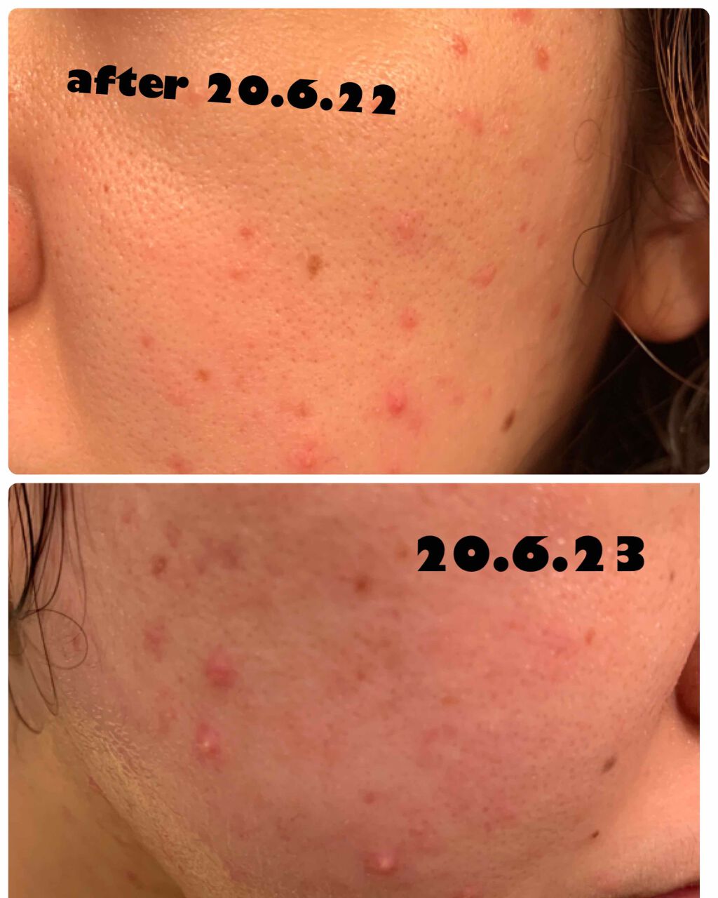 アロエ99% スージングジェル/HOLIKA HOLIKA/ボディローションを使ったクチコミ(3枚目)