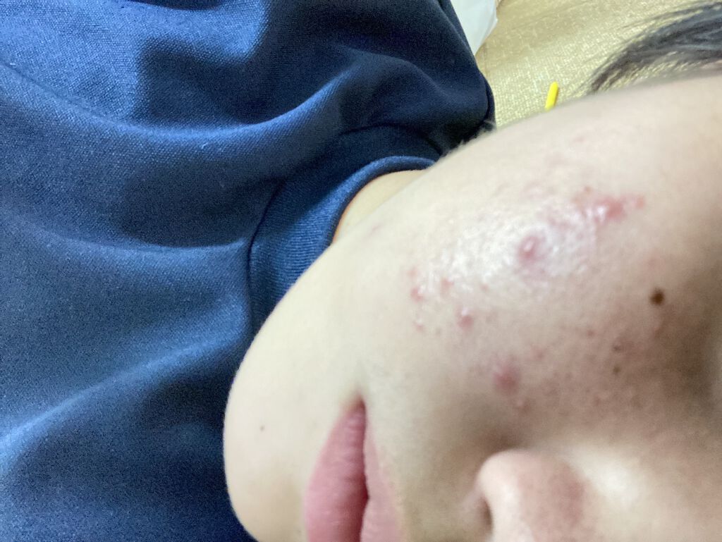 を使ったクチコミ（3枚目）