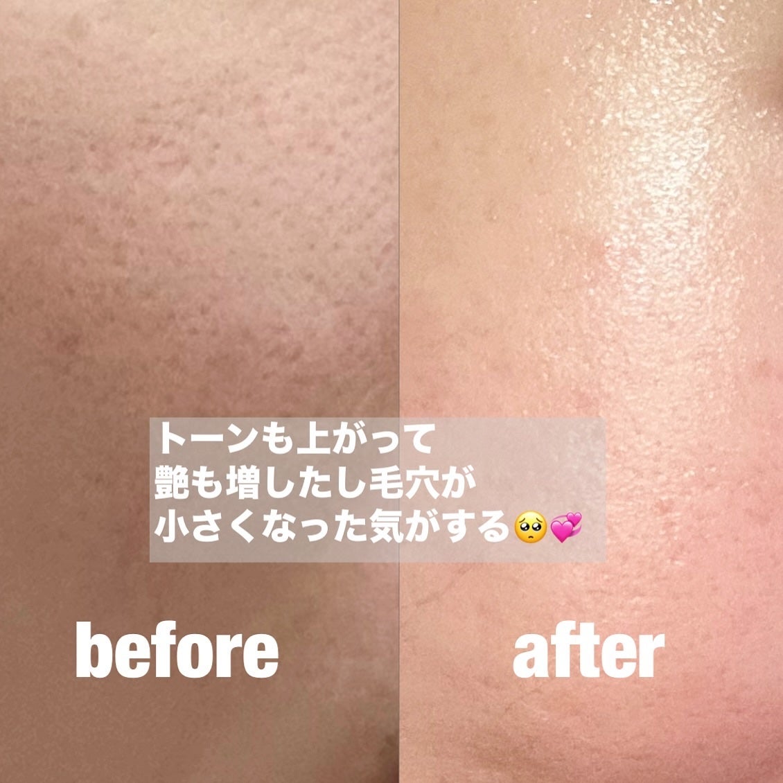 エクソソームシカ アンプル/MEDICUBE/美容液を使ったクチコミ(4枚目)