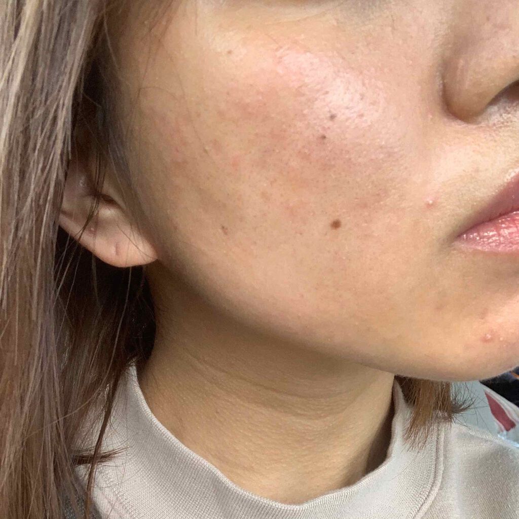 アミノモイスト トライアルセット/ミノン/トライアルキットを使ったクチコミ(1枚目)