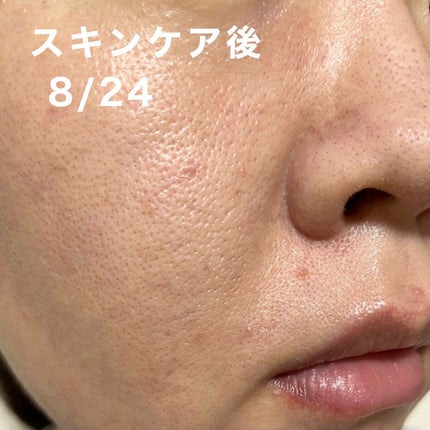 ザ・タイムR アクア/IPSA/化粧水を使ったクチコミ(6枚目)