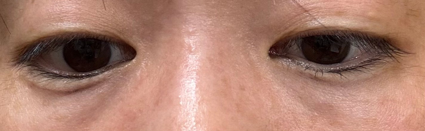 アイバッグコンシーラー/キャンメイク/ペンシルコンシーラーを使ったクチコミ(2枚目)