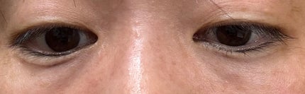 アイバッグコンシーラー/キャンメイク/ペンシルコンシーラーを使ったクチコミ(2枚目)